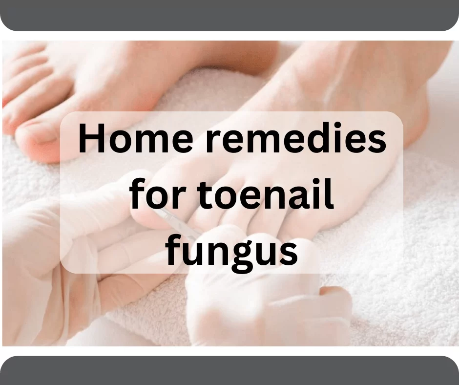 How can you treat toenail fungus (onychomycosis) using home remedies?