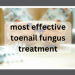 What's the most effective toenail fungus treatment for getting rid of onychomycosis?