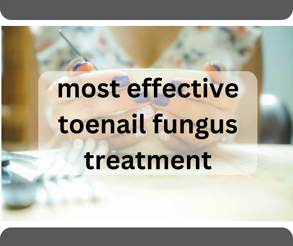 What's the most effective toenail fungus treatment for getting rid of onychomycosis?