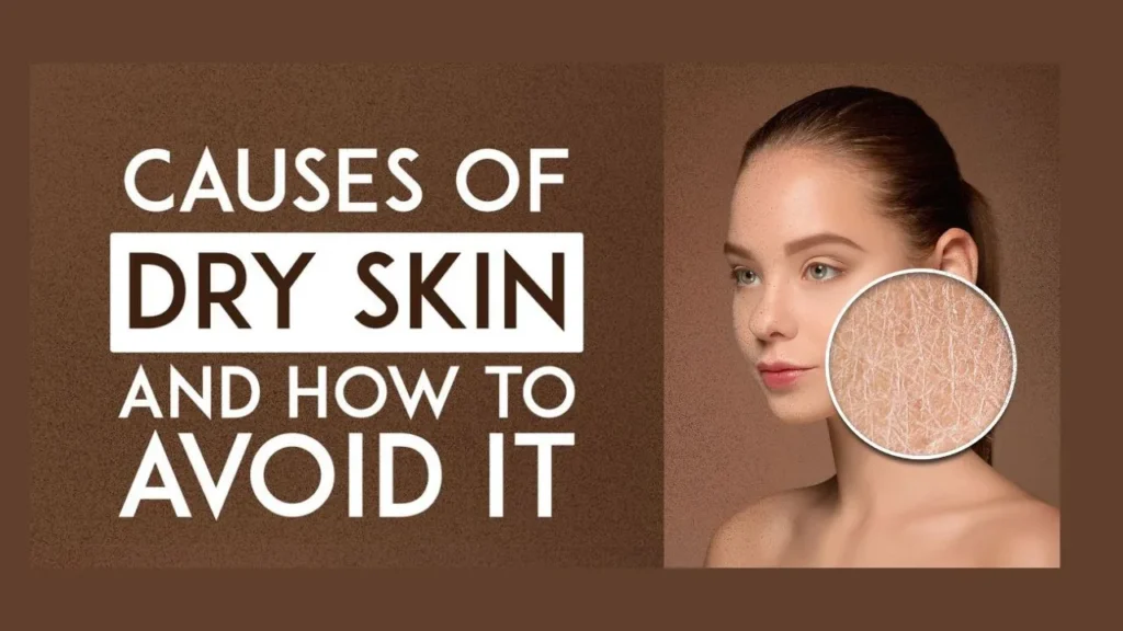 Simple Ways to Prevent and Treat Dry Skin
