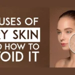 Simple Ways to Prevent and Treat Dry Skin