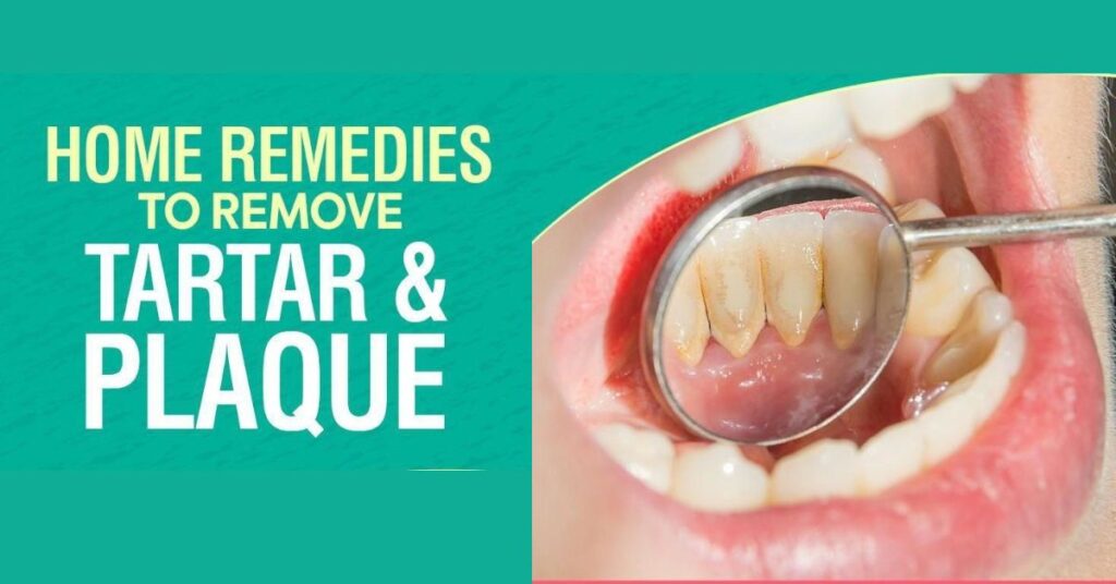 Remove Plaque and Tartar