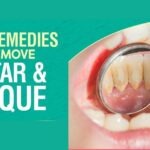 Remove Plaque and Tartar