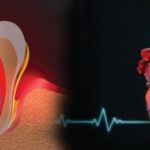 Oral Hygiene and Heart Health