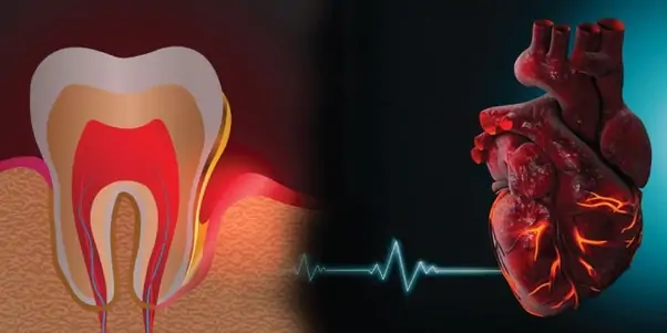 Oral Hygiene and Heart Health