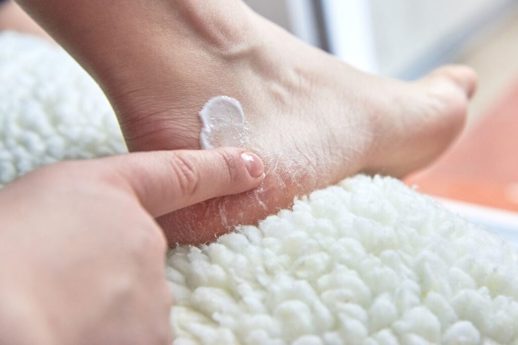 Why Is Toenail Fungus So Difficult to Treat? 3 women-applying-cream-toenail-fungus