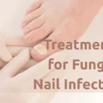 toenail fungus treatment blog post featured image