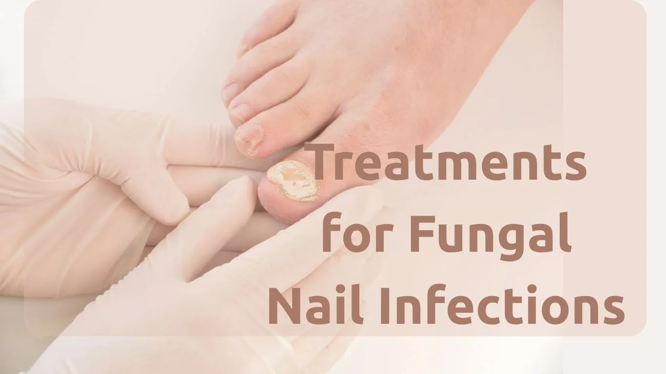 What Treatments Are Used for Fungal Nail Infections? A Real Breakdown of What Works 1 toenail fungus treatment blog post featured image